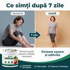 Varicalm