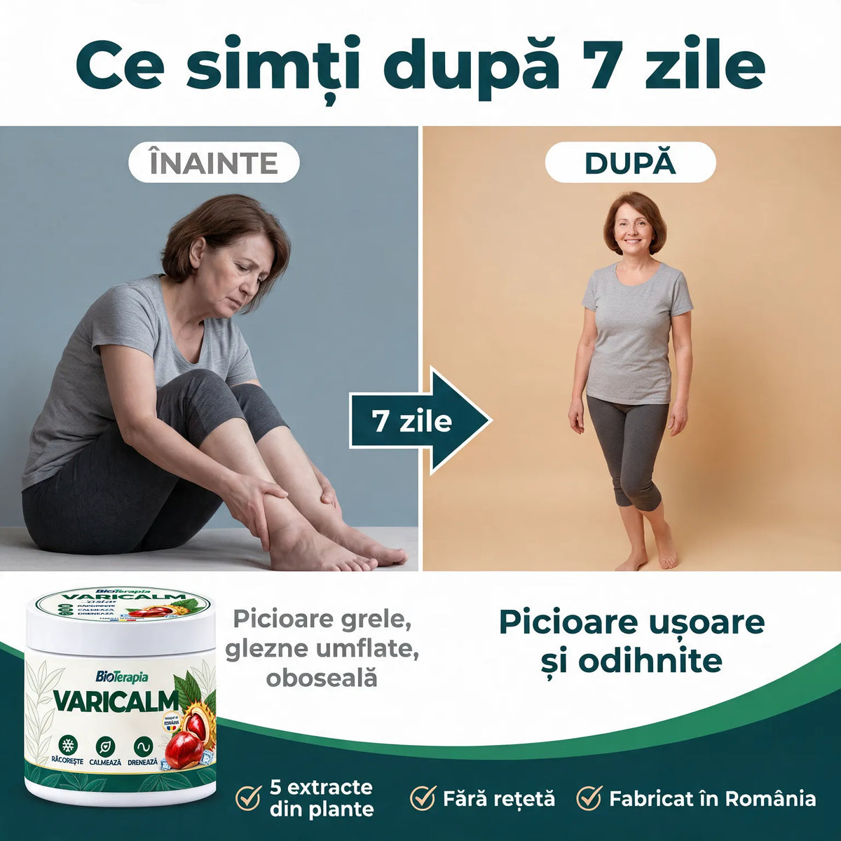 Varicalm
